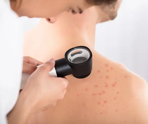 lekarz dermatolog